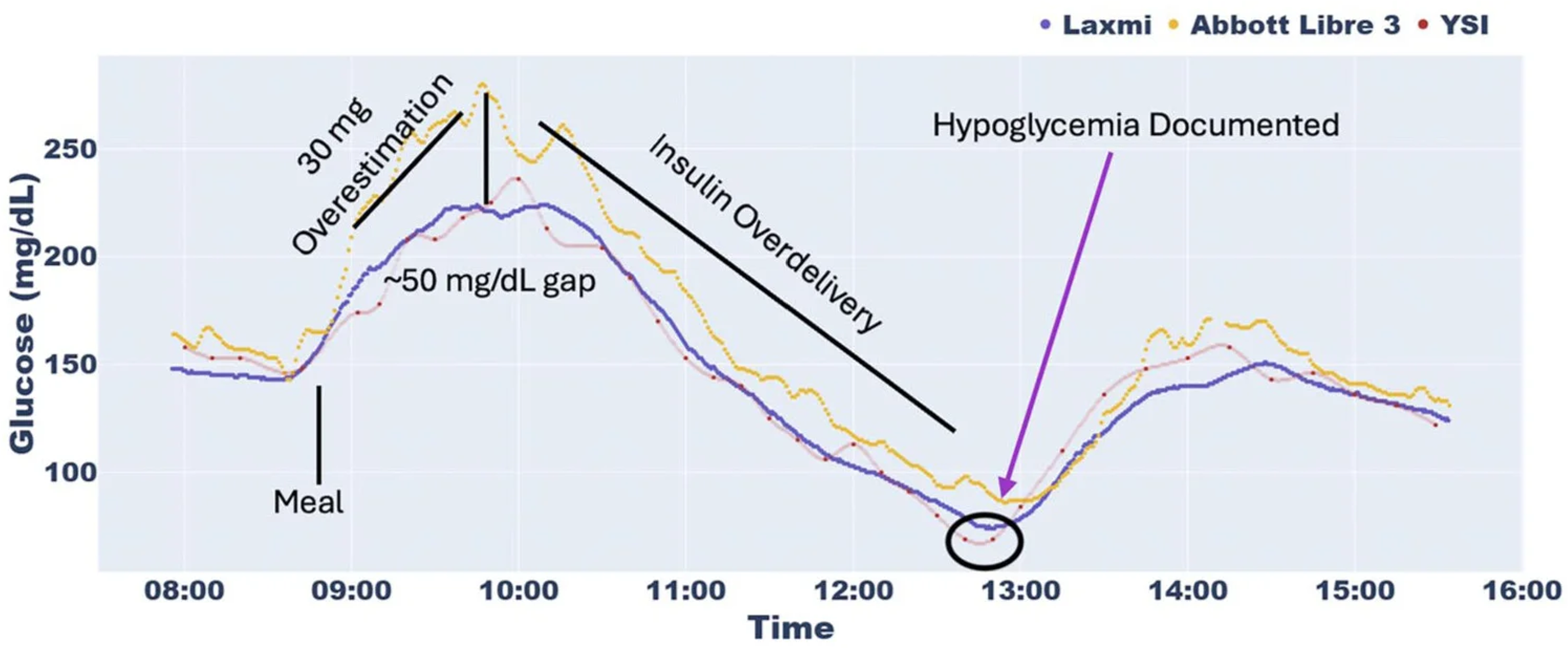 Glucose comparison chart showing Laxmi vs Leading CGMs